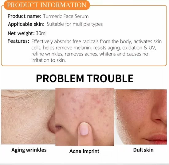 IBHW Lifestyle 30ml Kurkuma Serum | Hyaluronzuur | Opruiming | Turmeric | Hydraterend | Anti - Acne | Herstellend | Pigment | Dierproefvrij | Vegan | Glutenvrij | Natuurlijk | 25ml ISO Gecertificeerd | Voordeel | Aanbieding | Aloe Vera 8 IBHW Lifestyle 30ml Kurkuma Serum | Hyaluronzuur | Opruiming | Turmeric | Hydraterend | Anti - Acne | Herstellend | Pigment | Dierproefvrij | Vegan | Glutenvrij | Natuurlijk | 25ml ISO Gecertificeerd | Voordeel | Aanbieding | Aloe Vera - Afbeelding 8