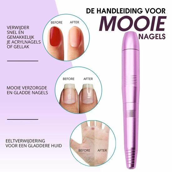 Merkloos La Liva Elektrische Nagelvijl - Nagelfrees - Inclusief Extra Schuurrolletjes Keramisch Bitje En Nagelborstel - Manicure Set - Gellak 4 Merkloos La Liva Elektrische Nagelvijl - Nagelfrees - Inclusief Extra Schuurrolletjes Keramisch Bitje En Nagelborstel - Manicure Set - Gellak - Afbeelding 4